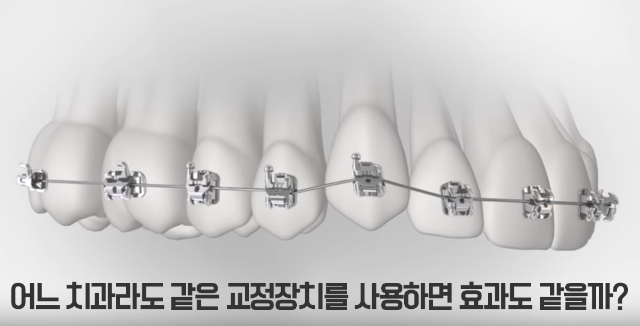 부평치아교정_5042.png